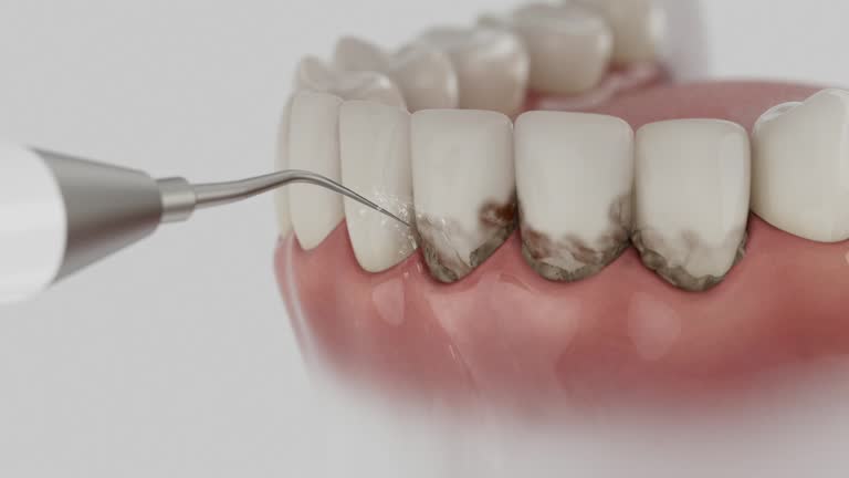 Trusted Teeth Cleaning And Checkup service in Burley, ID - Dentist Open Now